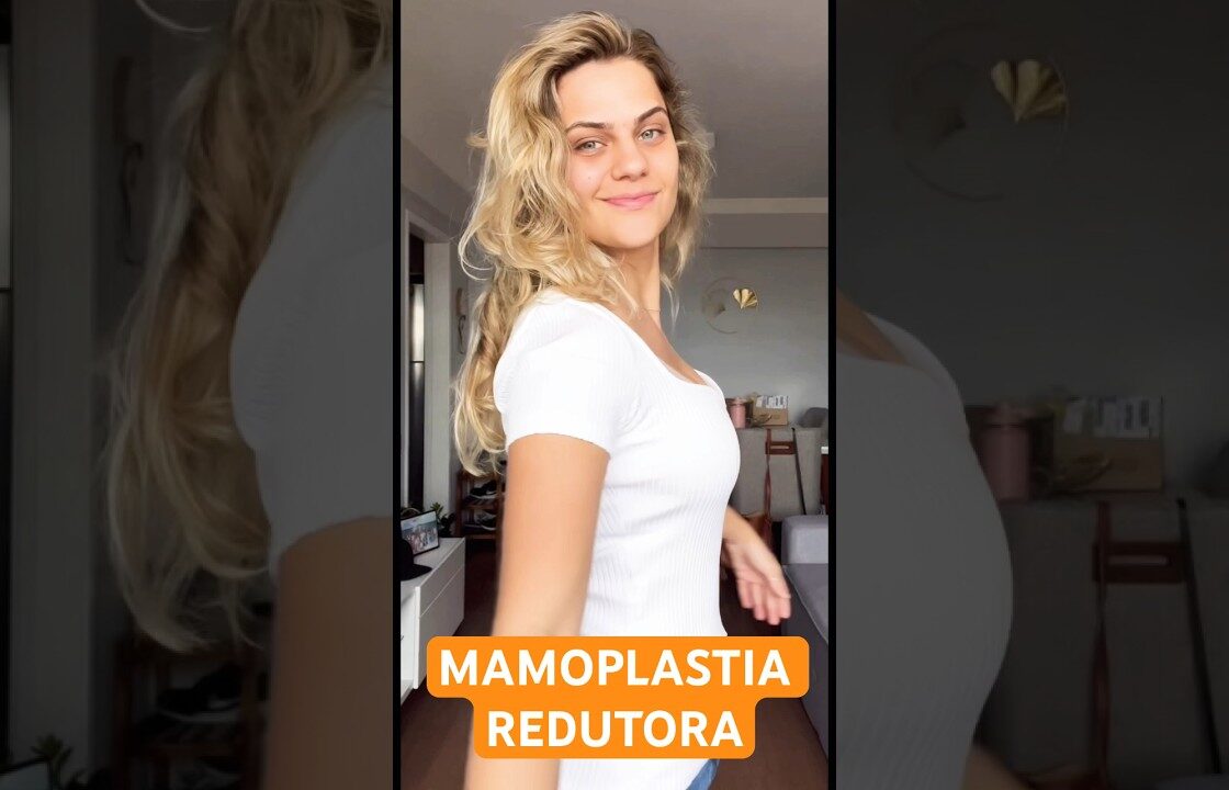 SOBRE BEM ESTAR #mamoplastiaredutora #mamoplastia #mastopexia #reducaodemama #cirurgiaplástica